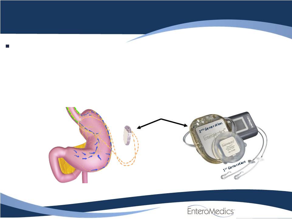 ReShape Lifesciences Inc. - FORM 8-K - EX-99.1 - ENTEROMEDICS CANACCORD